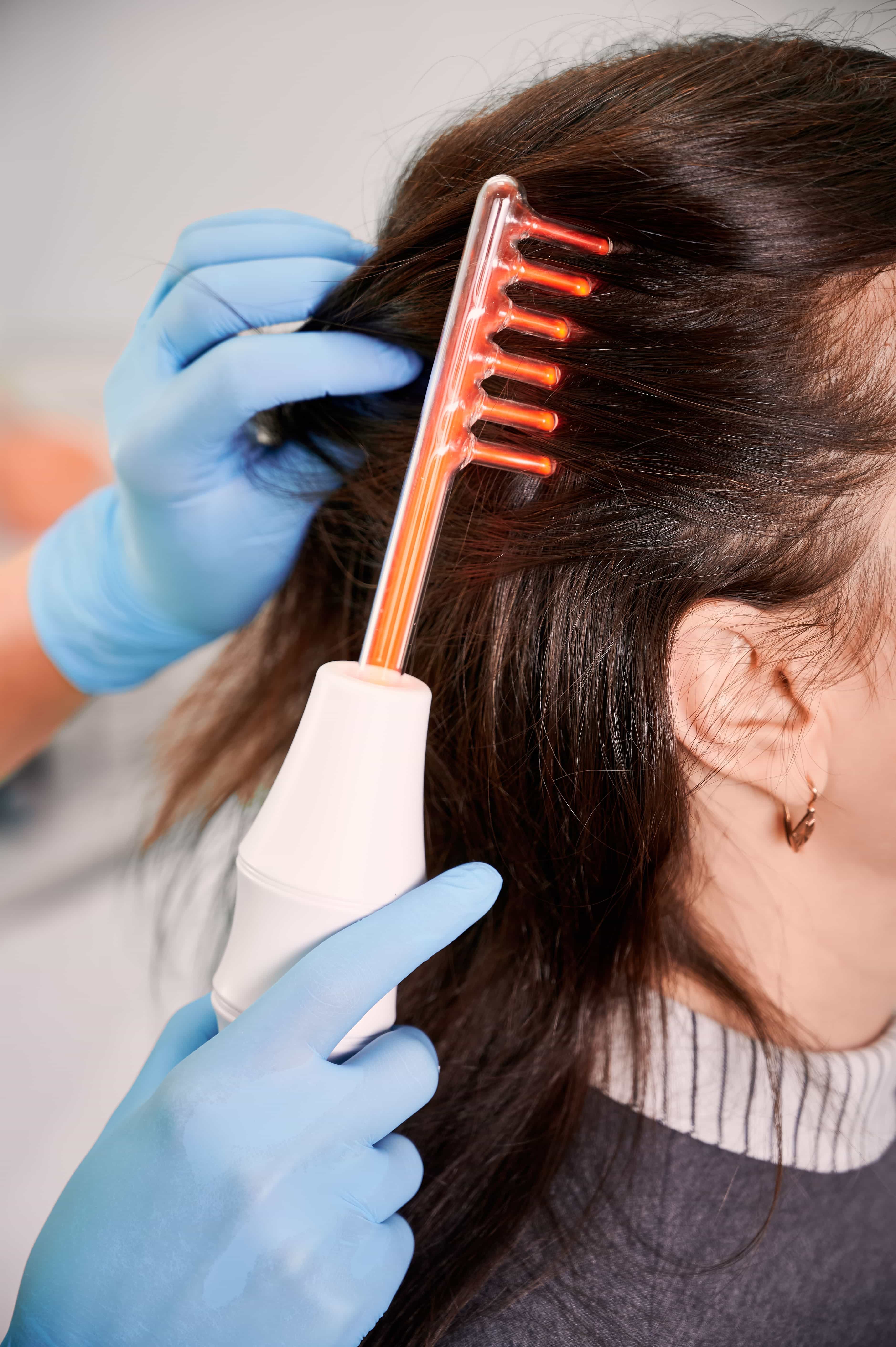 UK TVET Learning College | Hair Loss Treatment